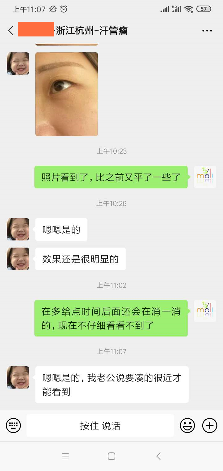 汗管瘤怎么才能消退干净？需要按照这些步骤来做(图1)